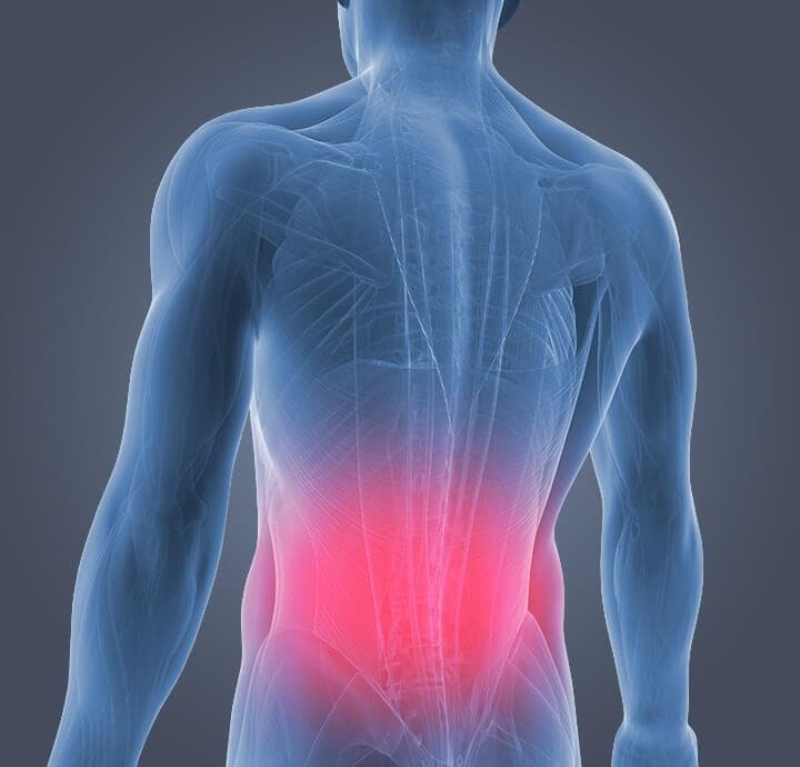Long Term Back Pain
