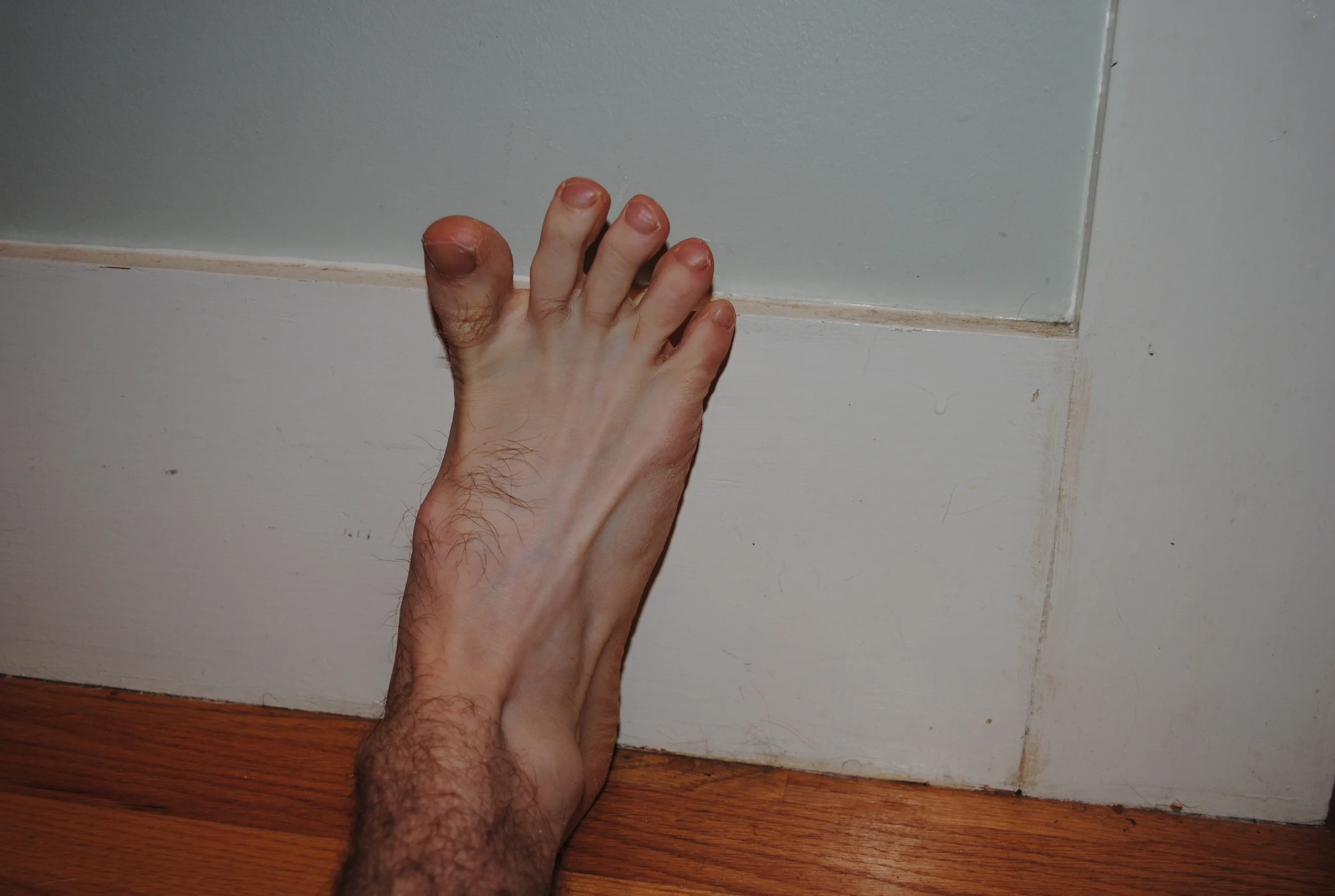 Spread your toes apart as far as you can.