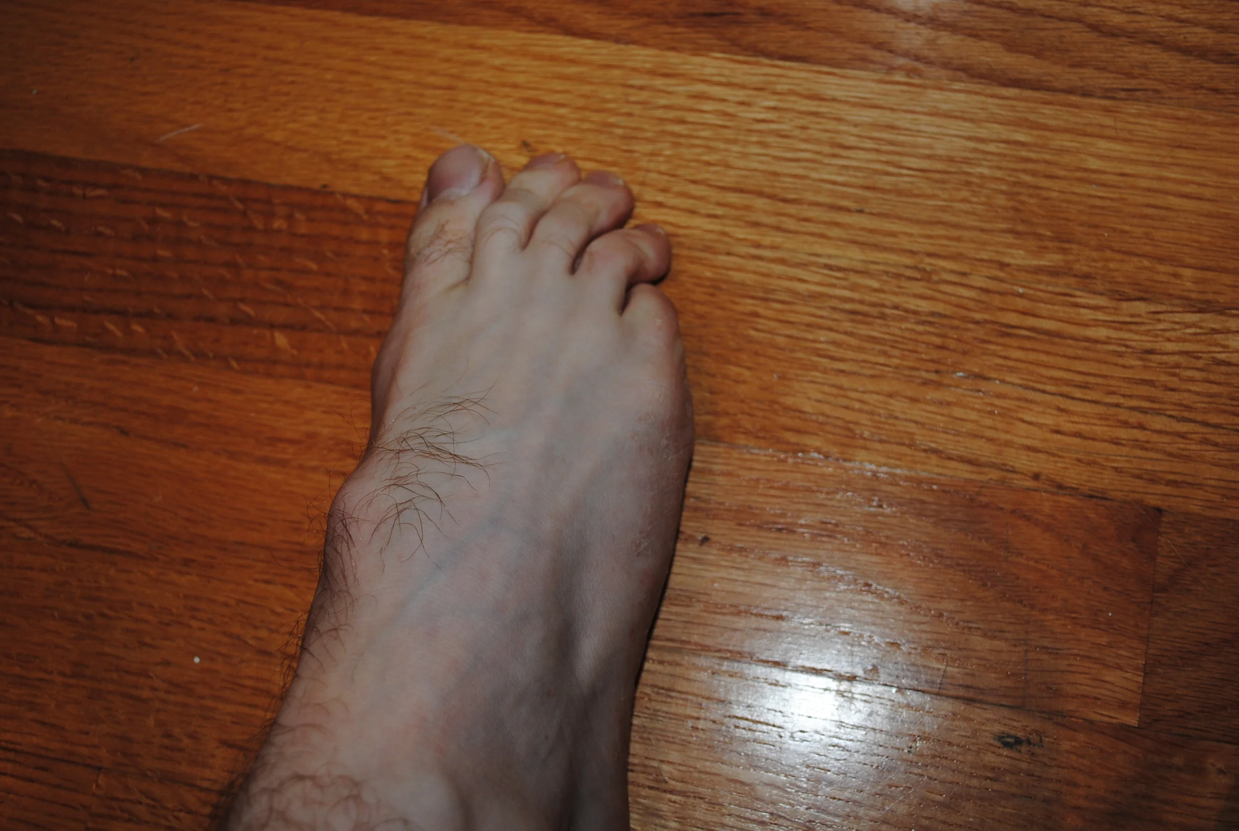 Squeeze your toes together.