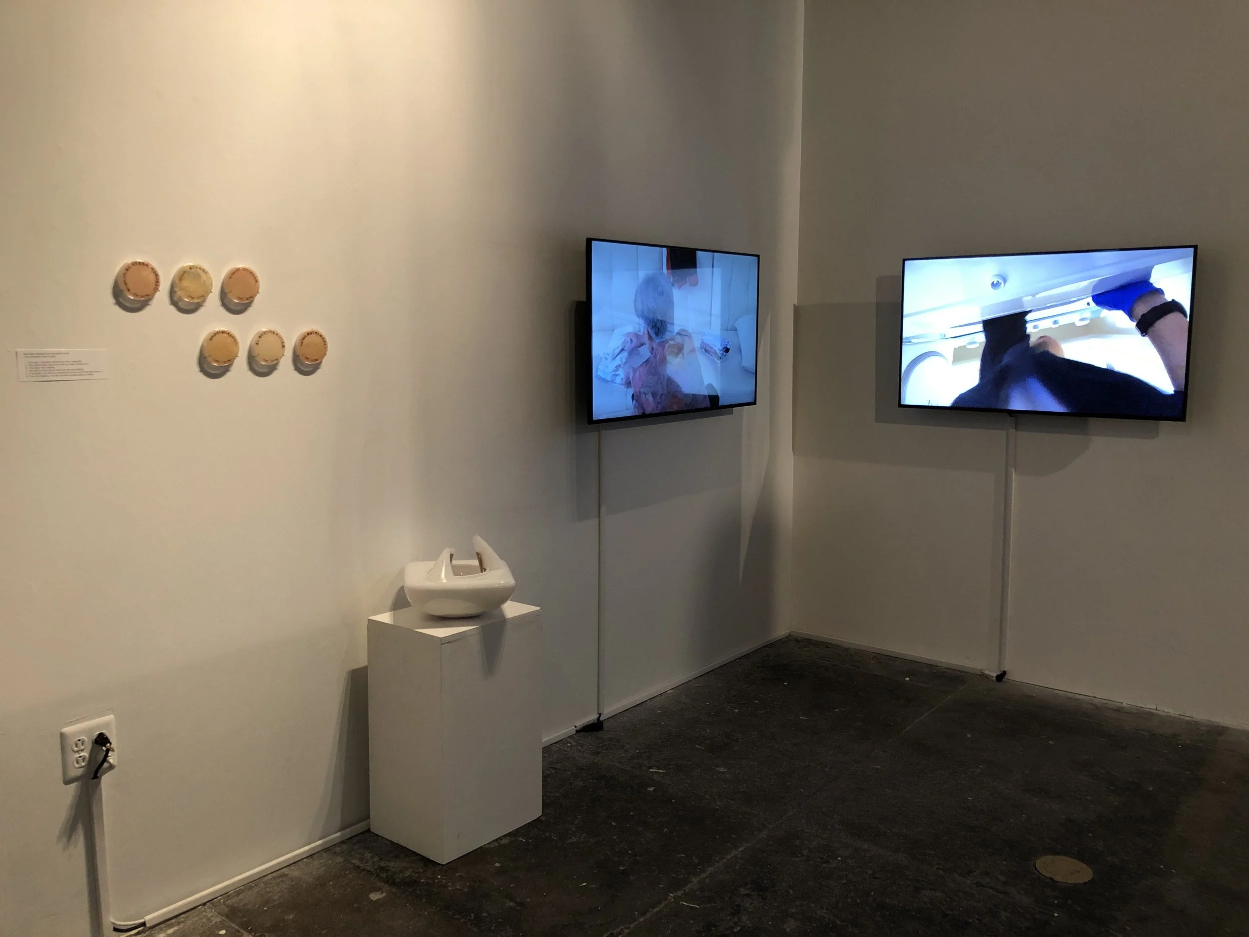  ( installation view ) 