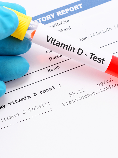 vitamin_test.png
