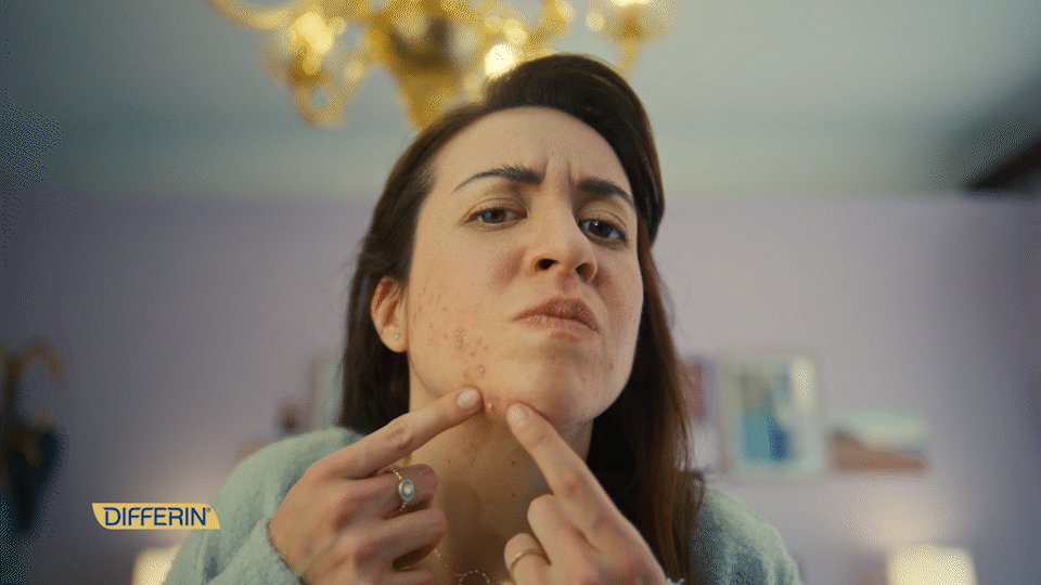 Differin_Pickers_45_CUT_014A_ALT_AdobeExpress (1).gif