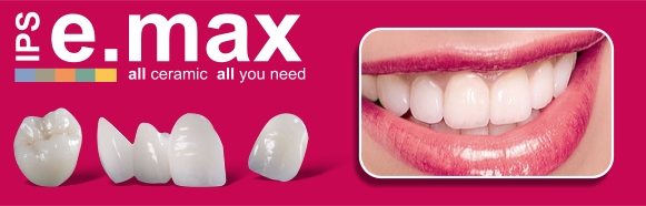 Emax Crown Restoration Services - Blue Box Dental Laboratory