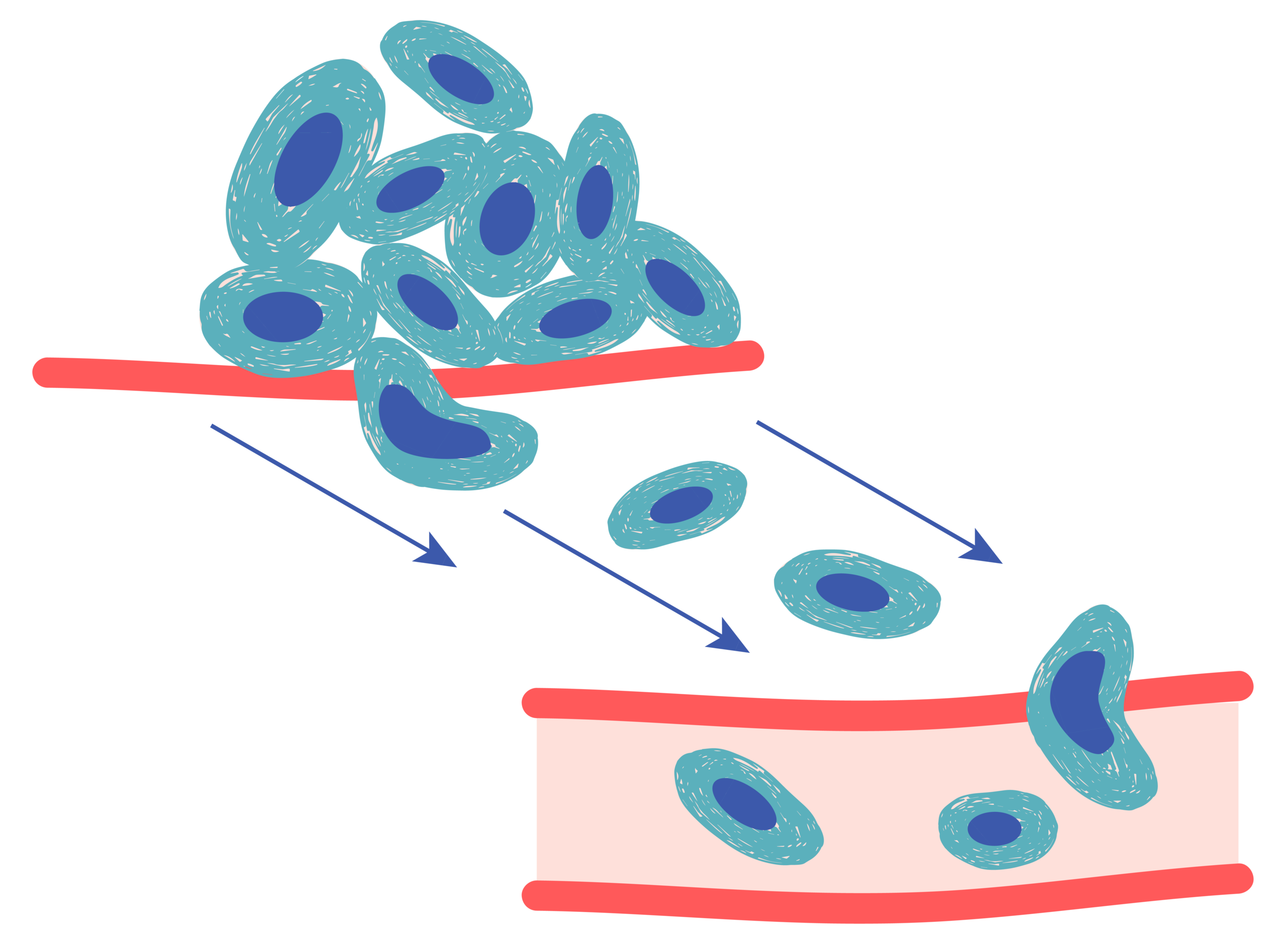 Metastasis.png