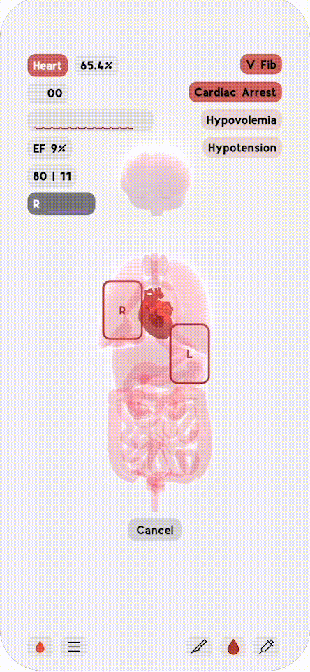 Defibrillation.gif