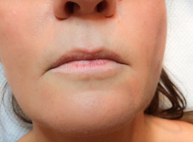 Permanent Make Up Lippen vorher.jpg