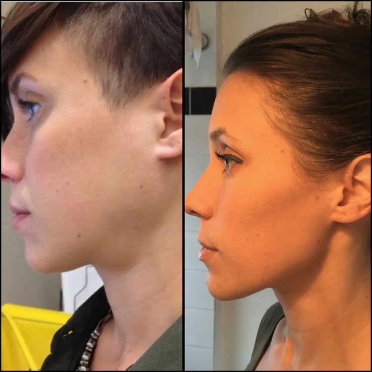 3 Easy Actions that Stimulate Recovery but Don’t Confront the Eating Disorder