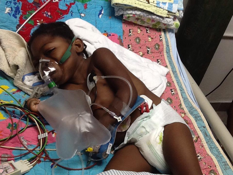 This is Dahicha after surgery during a unsuccessful trial period off the vent.