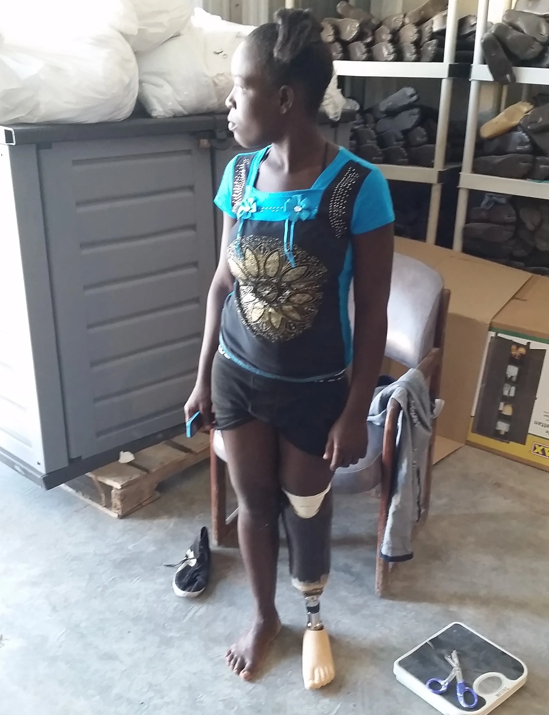 Marie with her improved old Prosthesis.