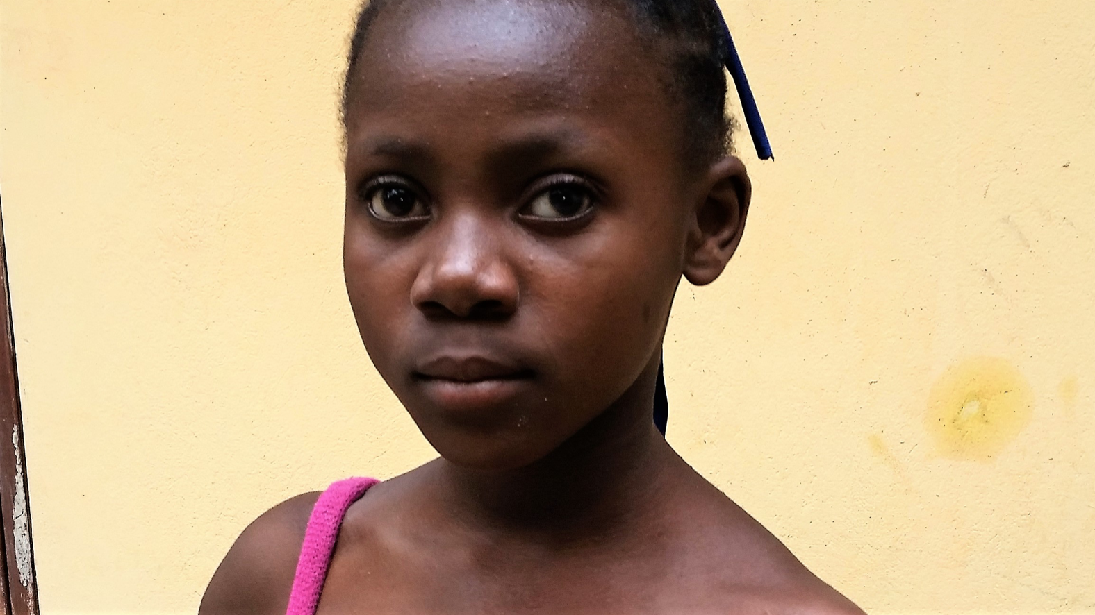 Watch for the next update to see the rest of this picture and find out how you have given hope and are changing the life of this child!