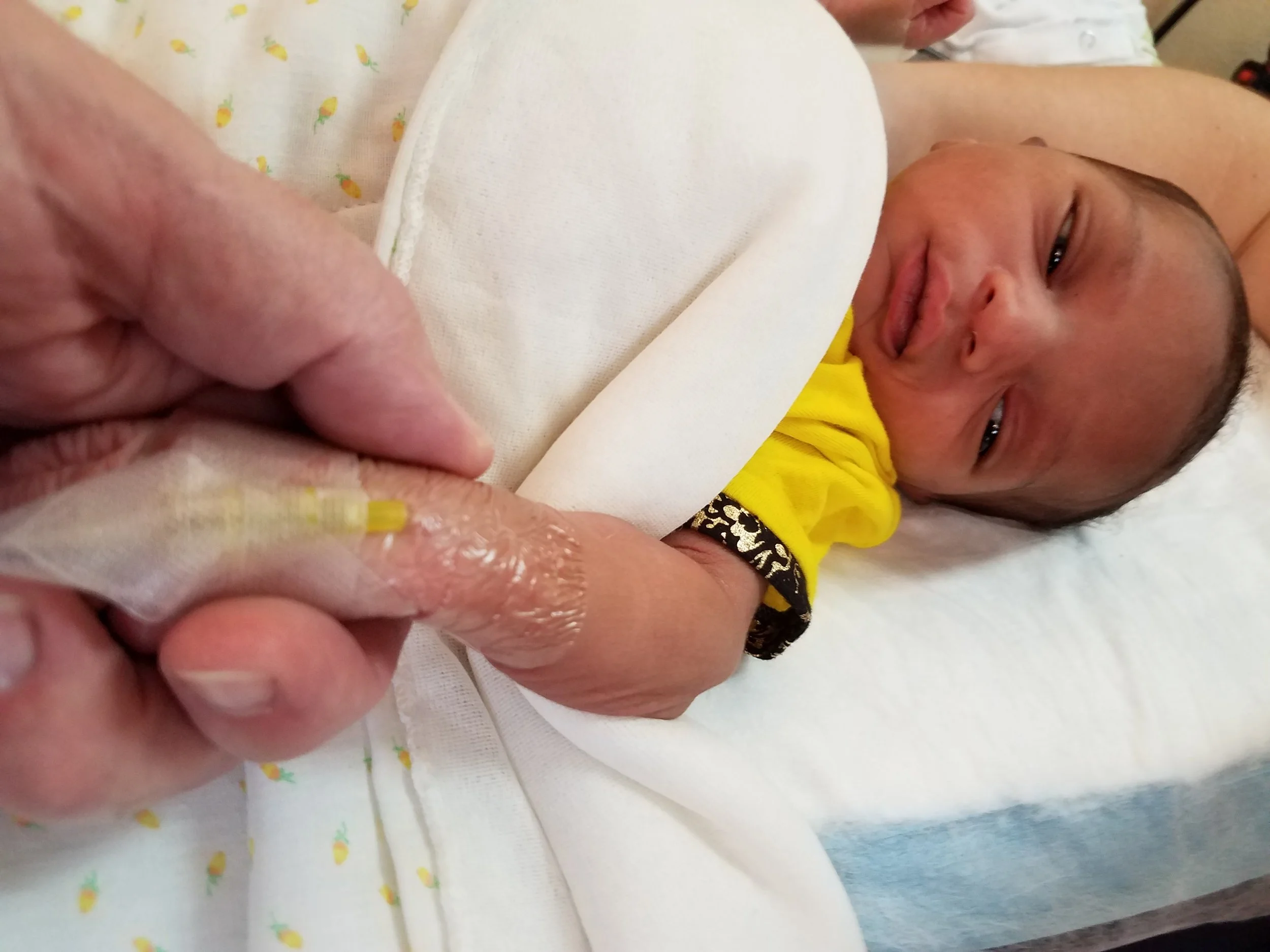 An IV is the result of poor maternal care due to lack of basic knowledge about children.