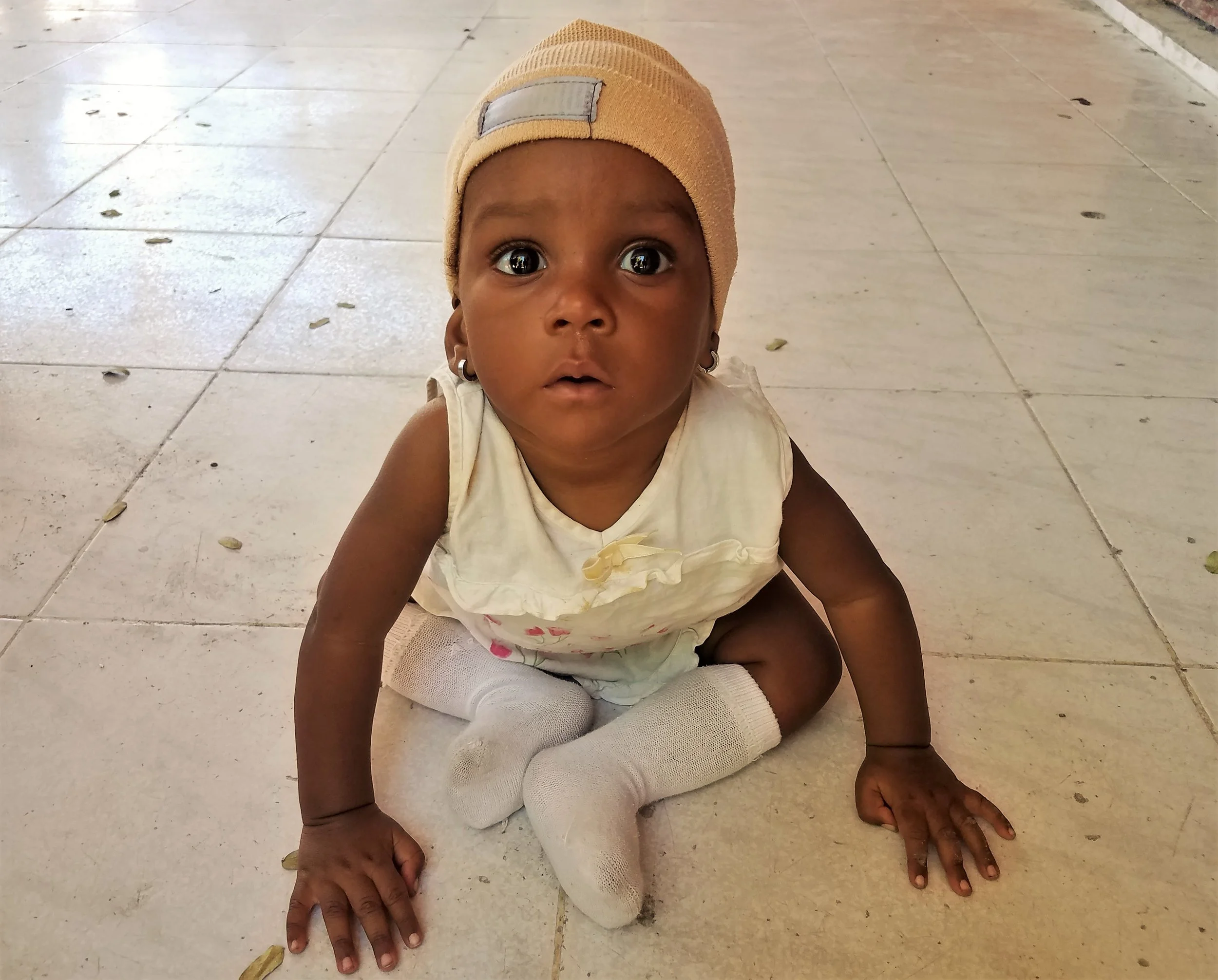 One of the most recent graduates from the malnutrition program!