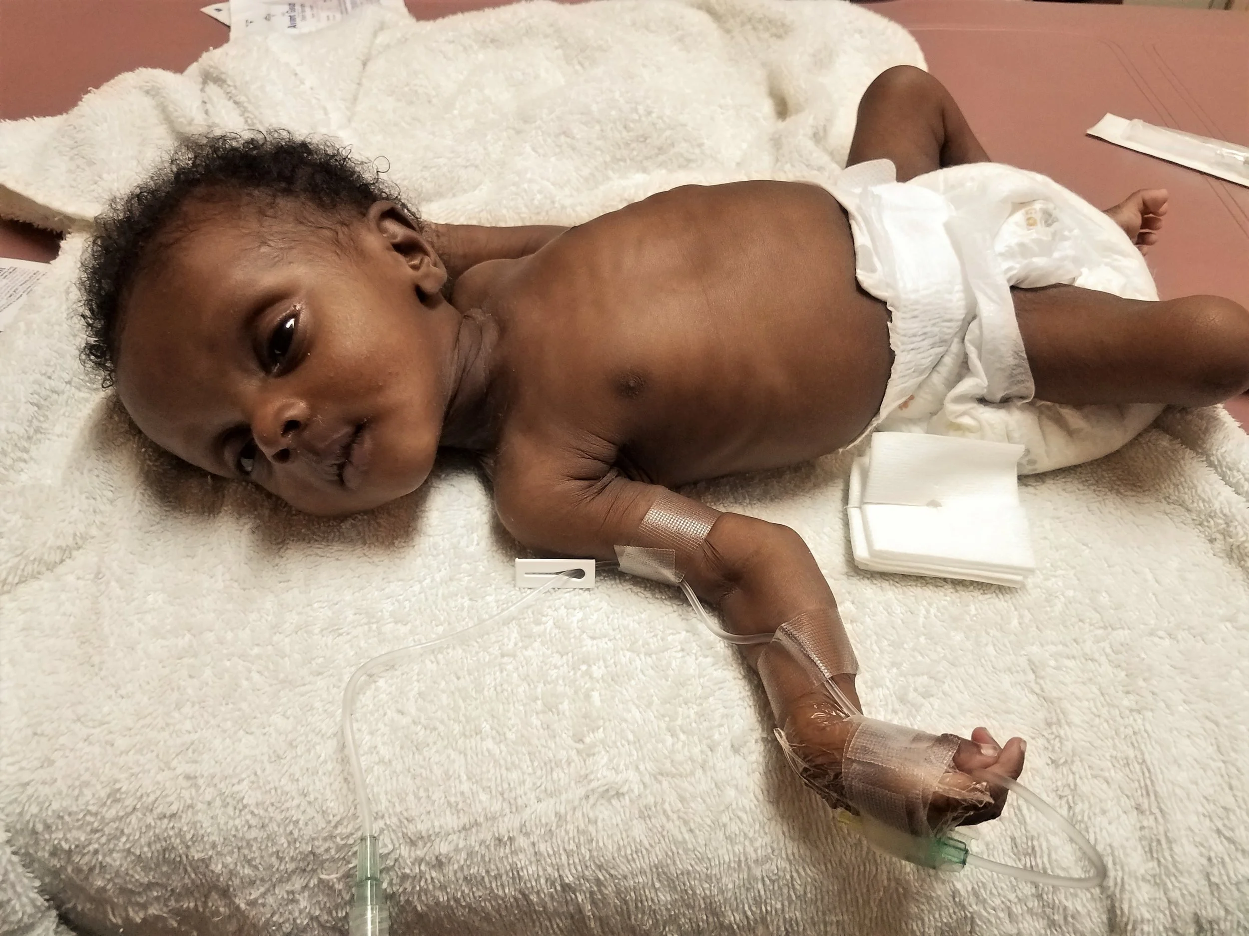 Loveson doing better with some IV fluids