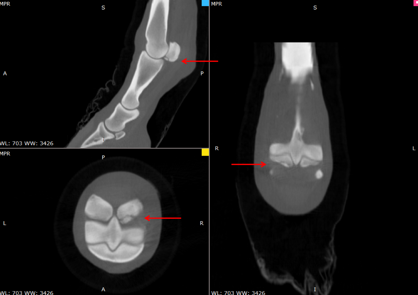 5yo Quarterhorse with fractured fetlock