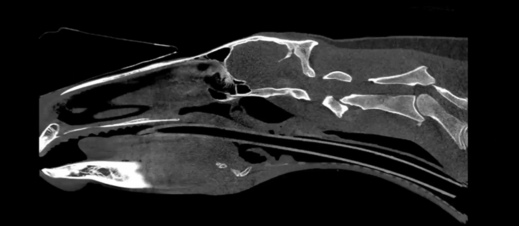 Neck Injury