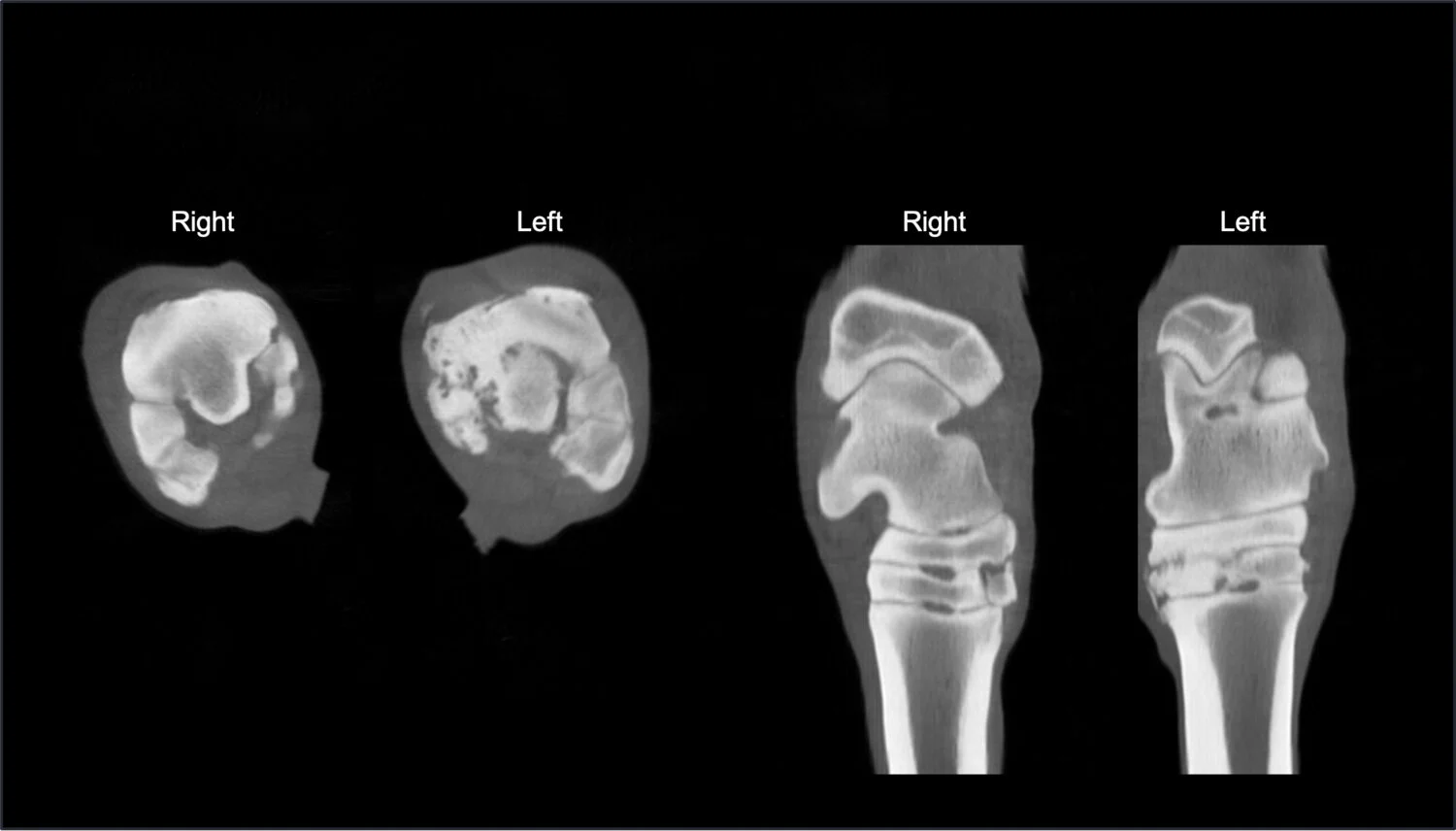 Osteoarthritis in the Hocks