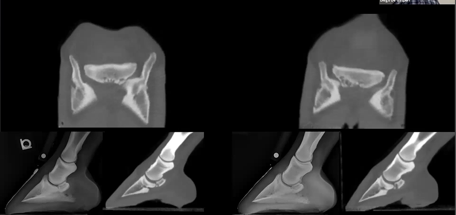 Navicular with Distal Boarder Fragmentation