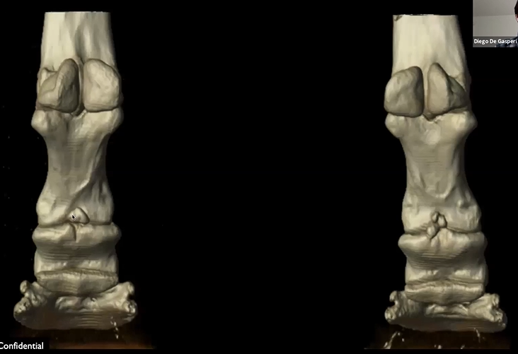Fragmentation of the Middle Phalanx
