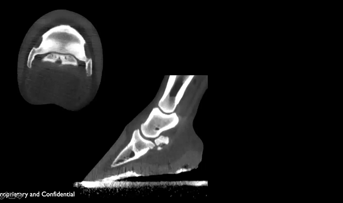 Navicular with Synovial Invagination