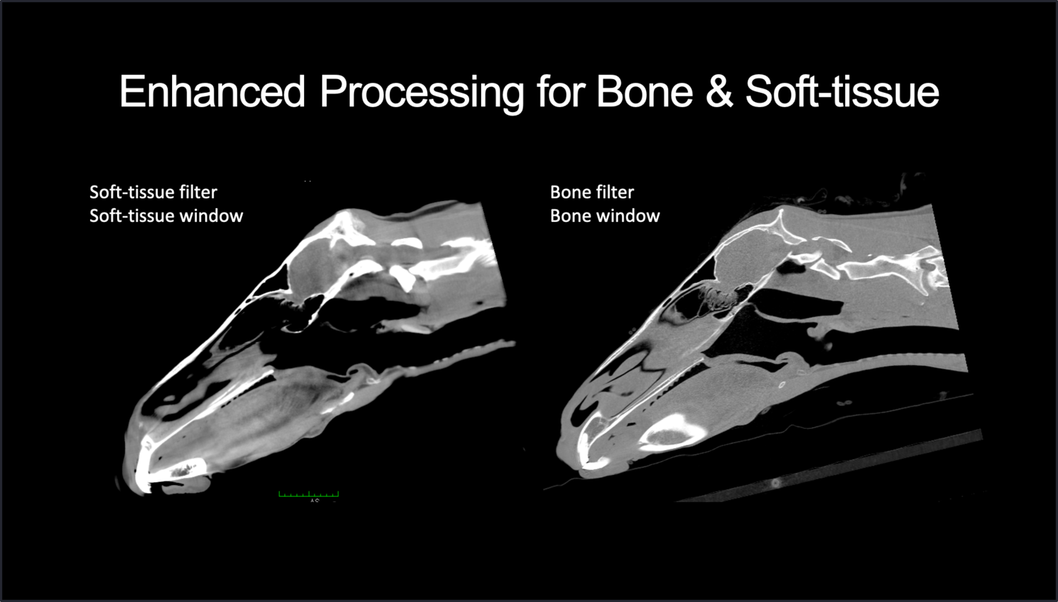 bone vs soft tissue filter.png