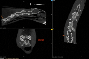 Asto CT from Inception to Present Day and the Future