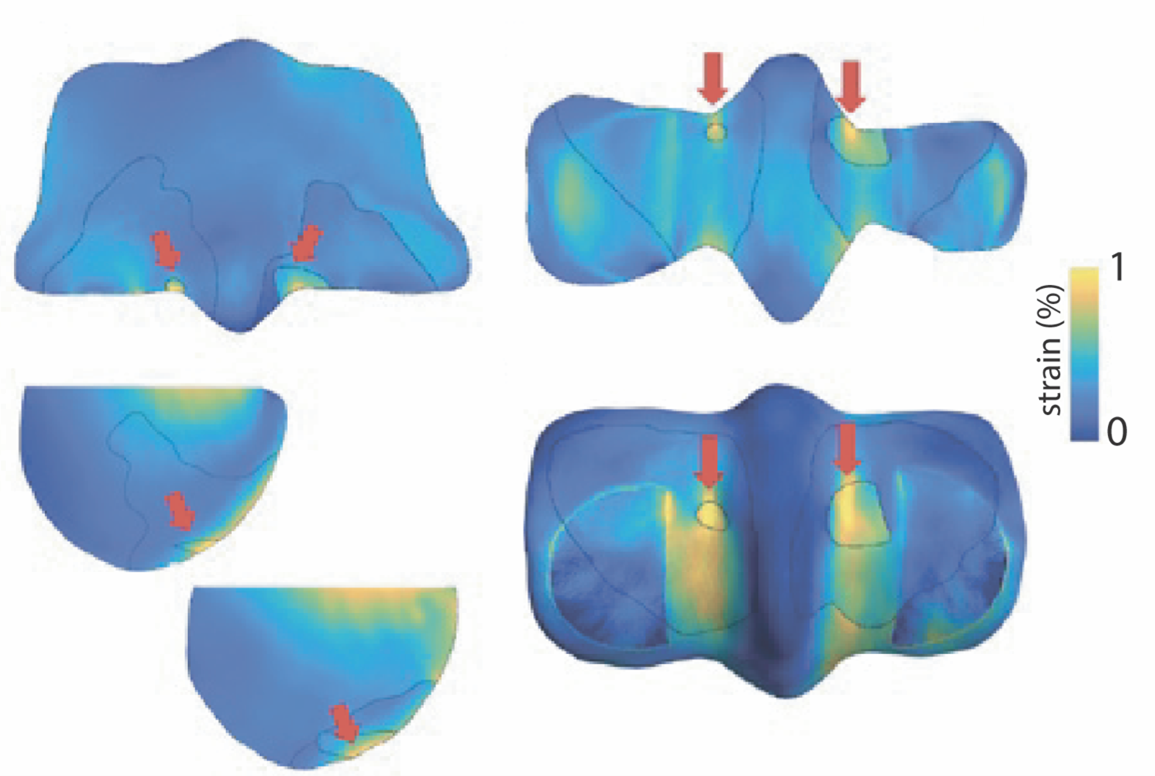 Infographic: Can We Predict Fetlock Stress Fractures Before They Happen?