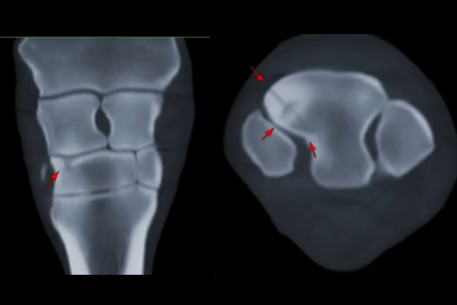  Distal Carpal Bone Fracture in a 14‑Year‑Old Warmblood Gelding