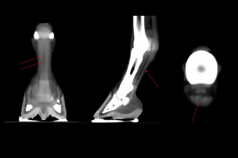 Progressive Deep Digital Flexor Tendon Injury Evaluated with Standing CT
