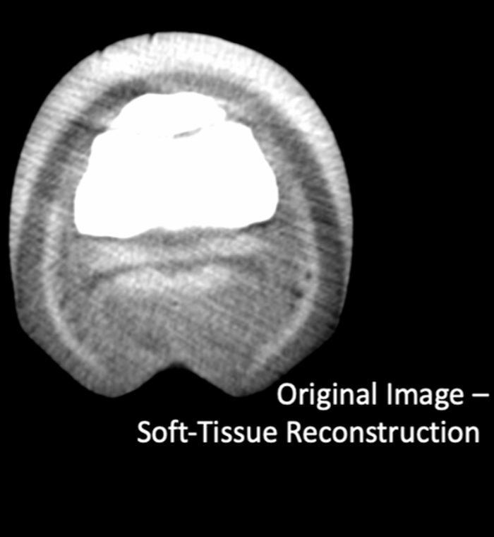 Original soft-tissue CT reconstruction