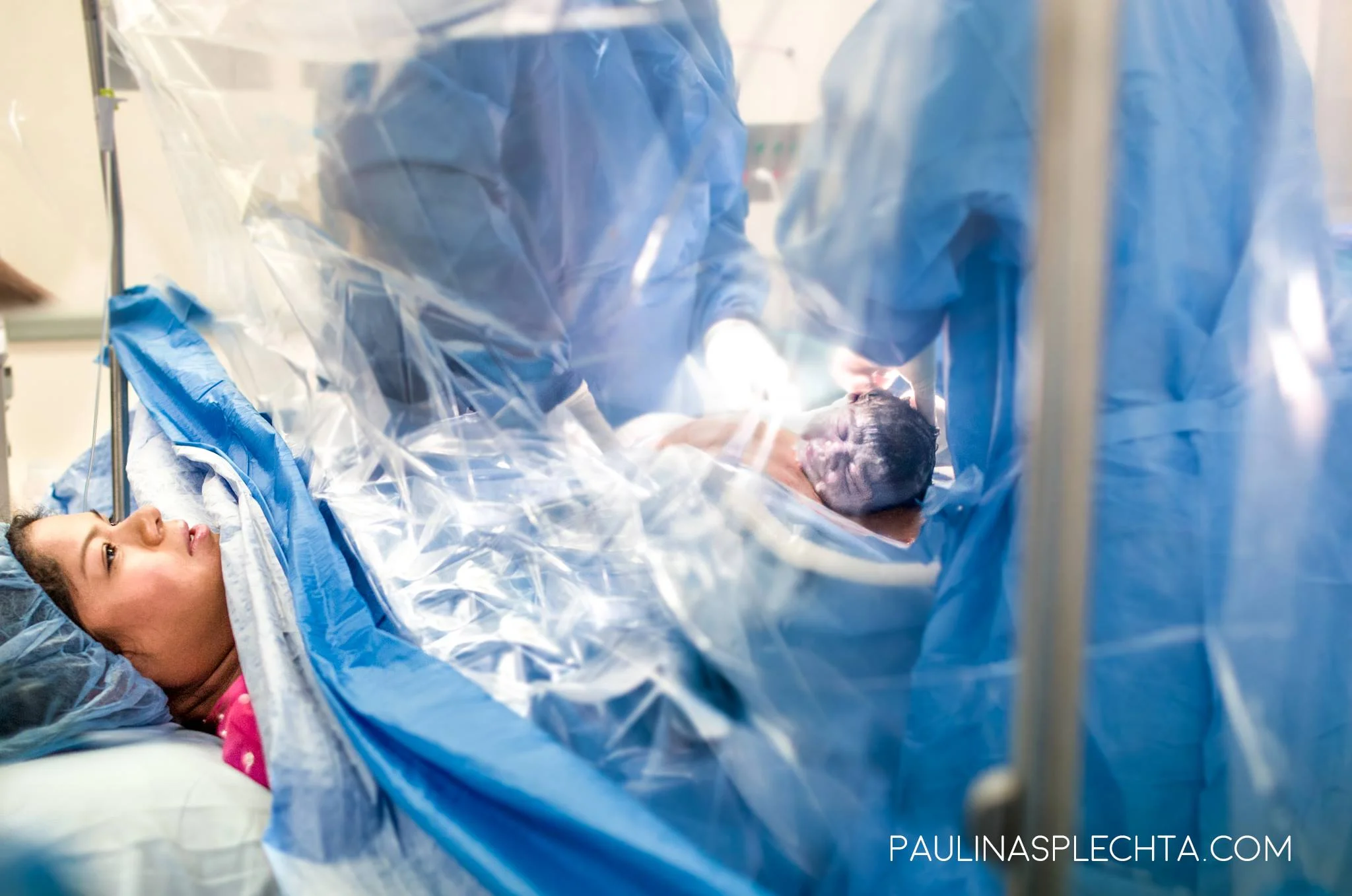 Gentle Cesarean In Boca Raton Boca Raton Birth Photographer Paulina Splechta