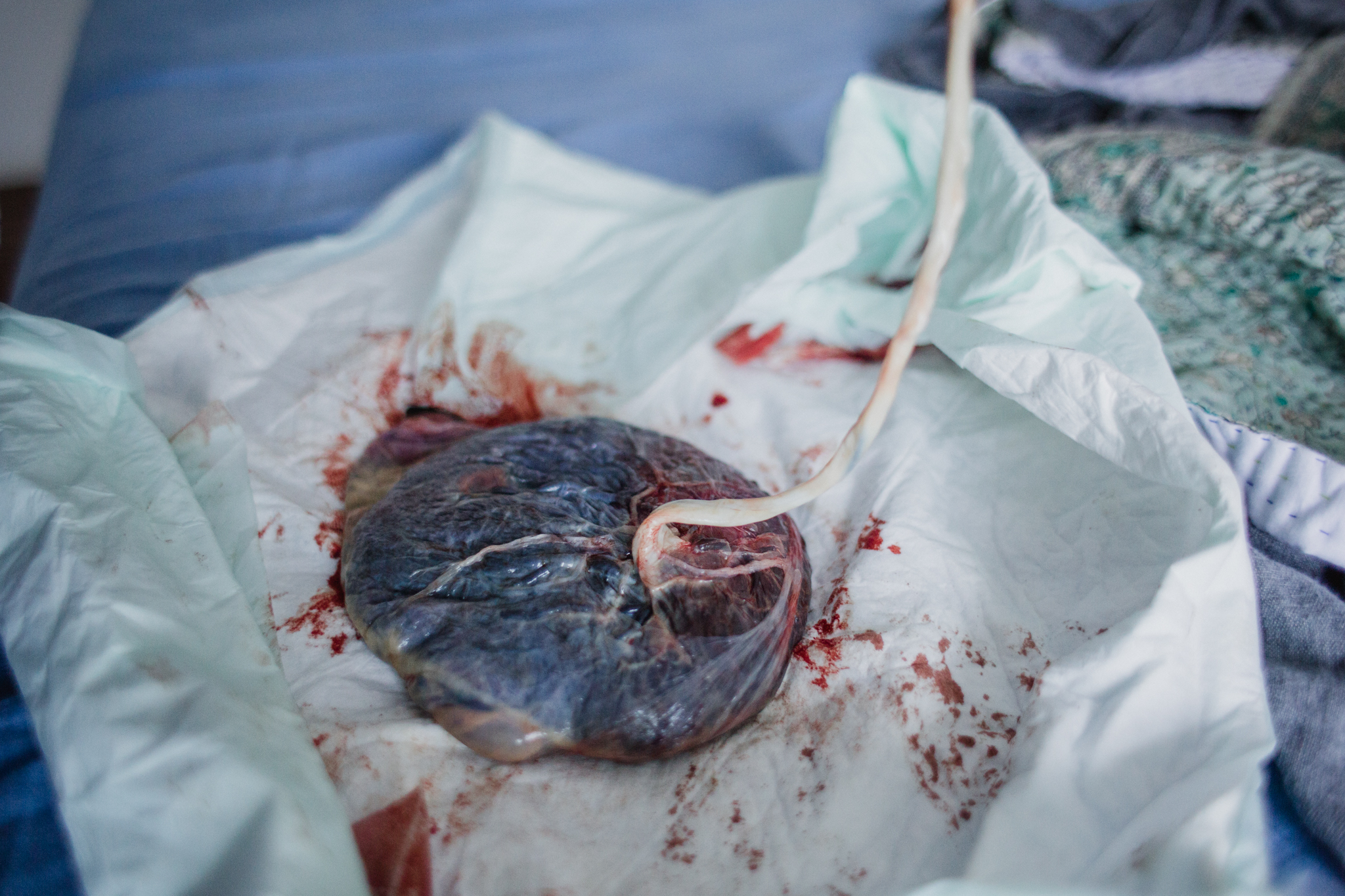 placenta and umbilical cord.jpg