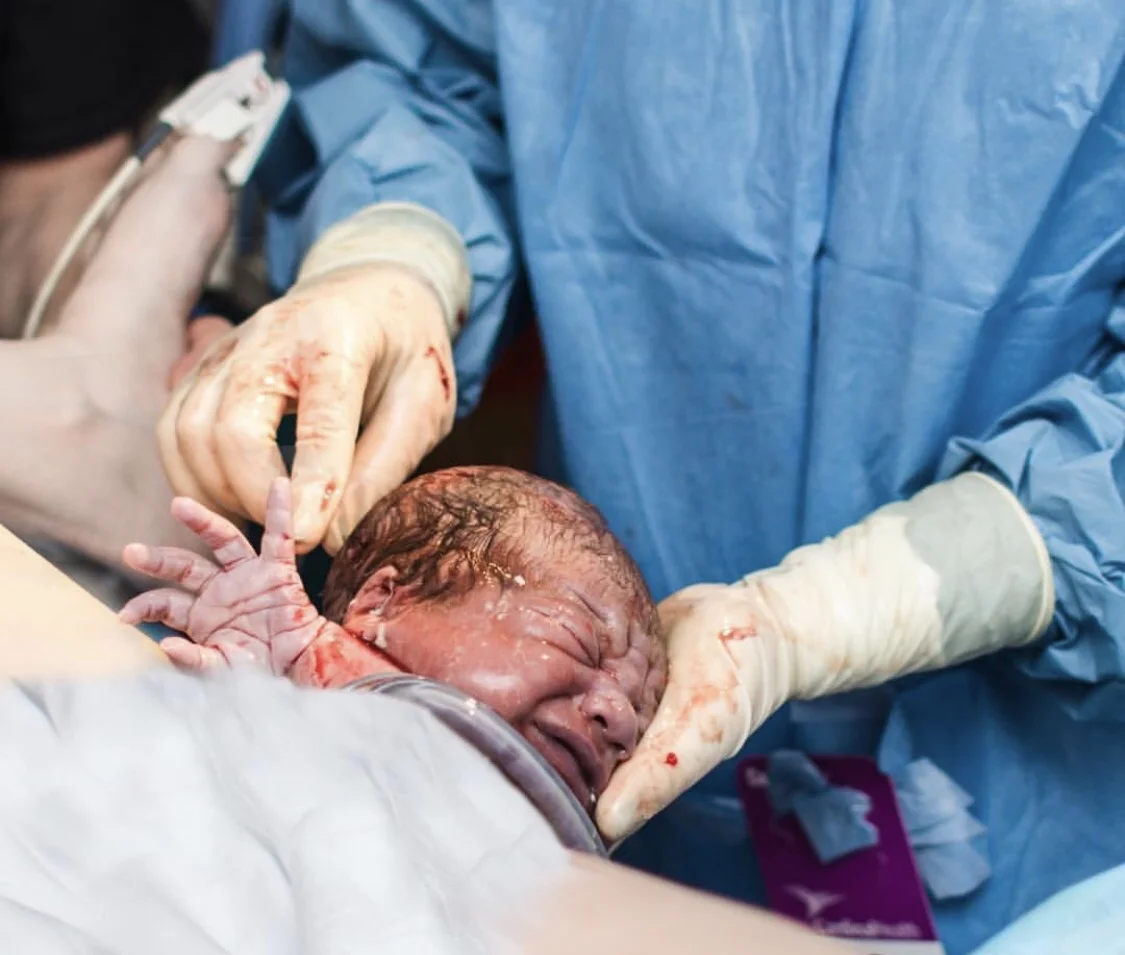 cord around the babys neck.jpg