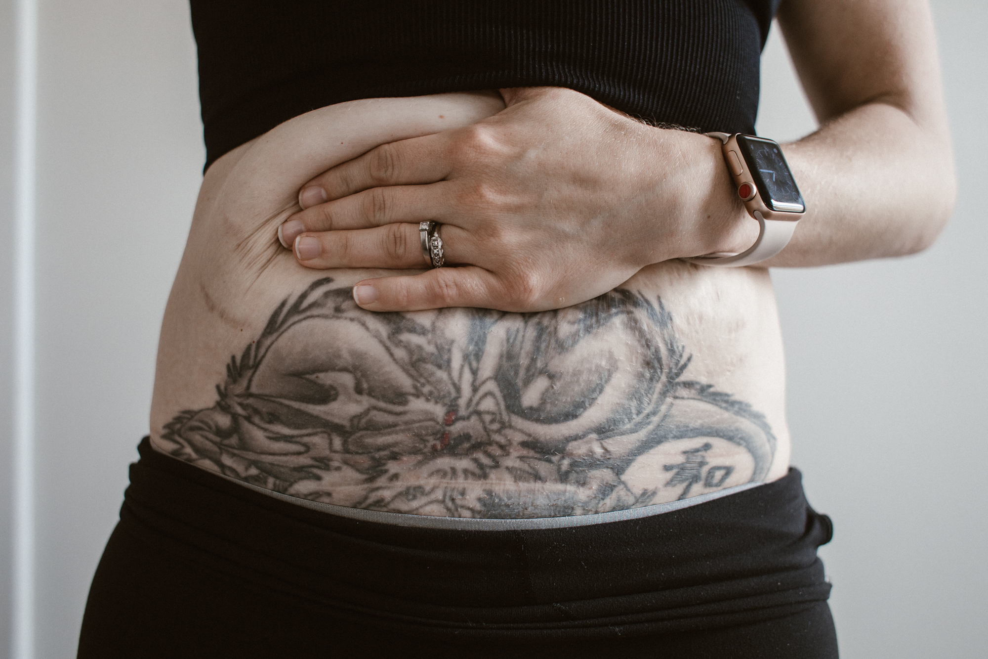 This Photo Shows That Loose Skin Is Normal After Giving Birth