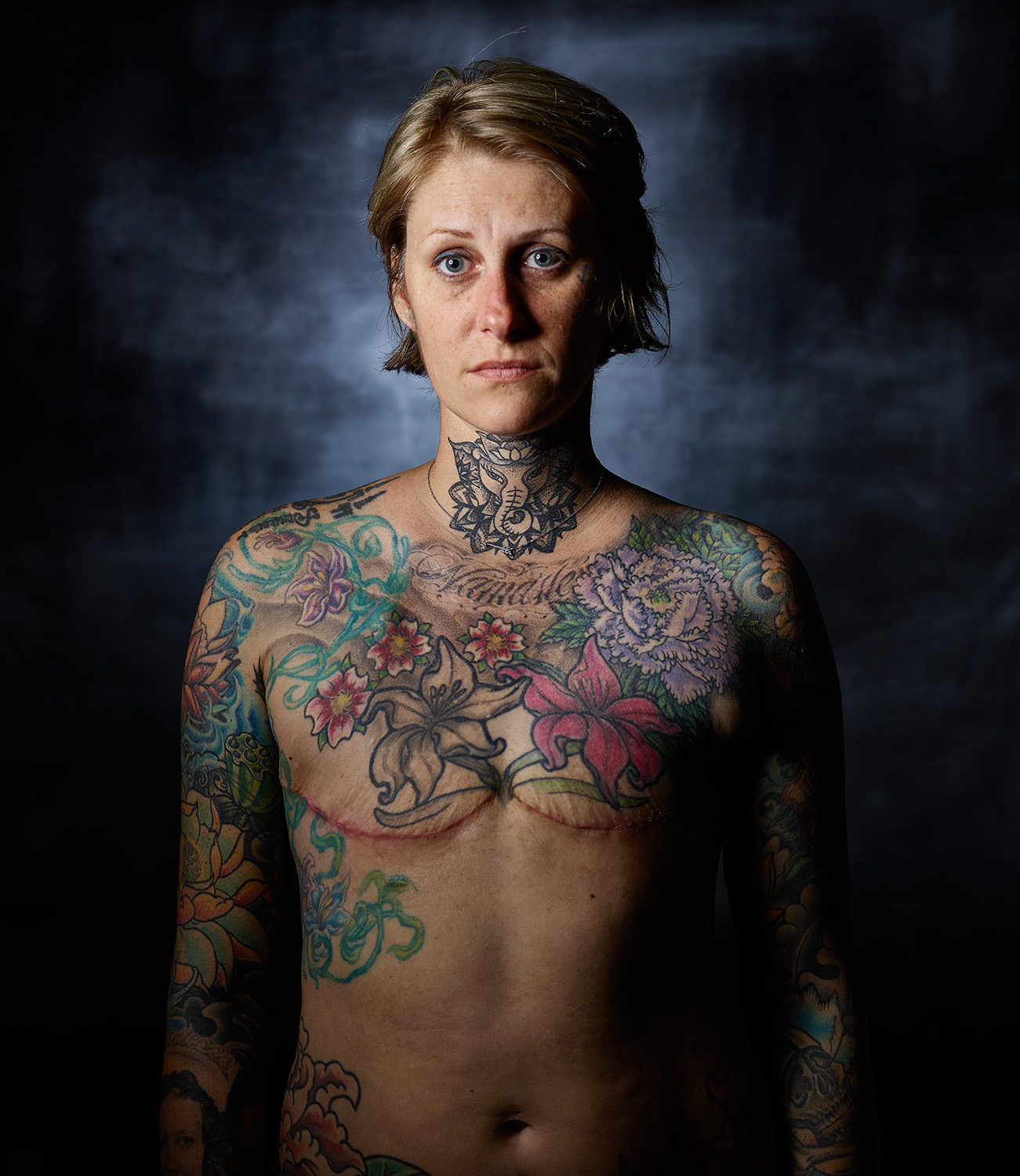 Woman with Metastatic Breast Cancer