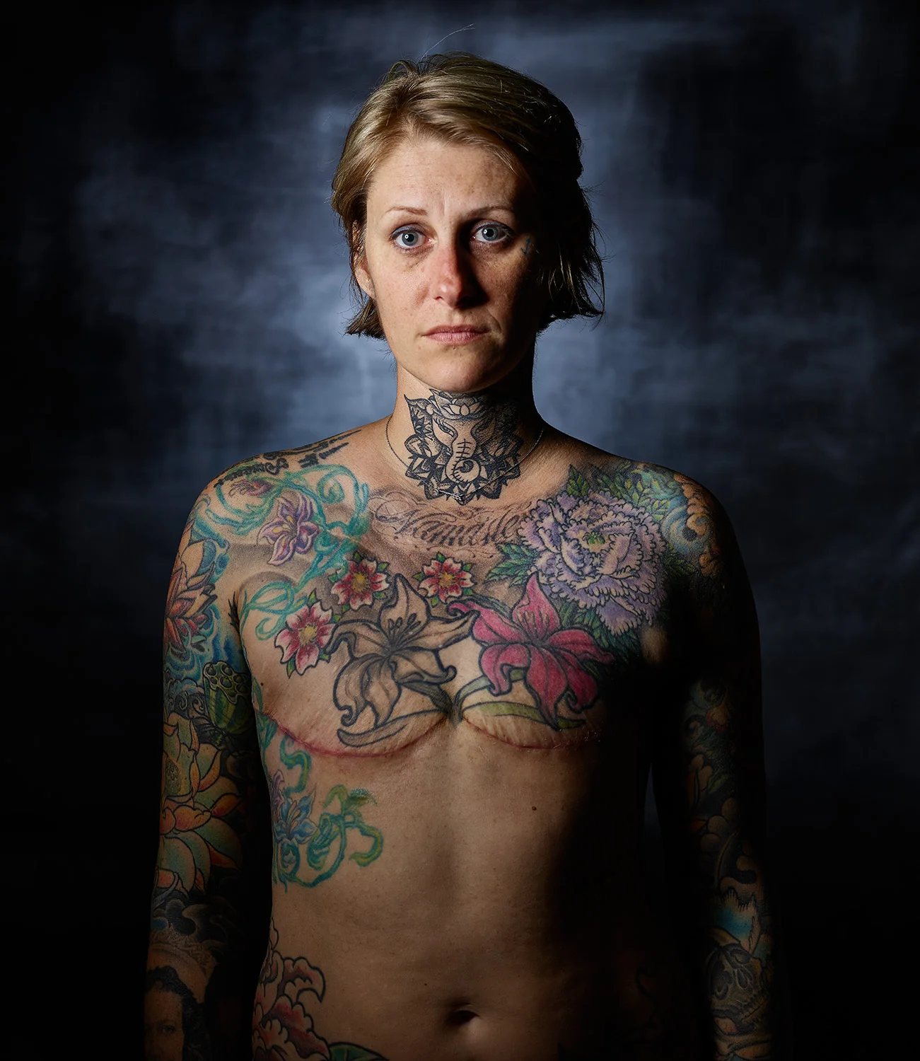 Woman with Metastatic Breast Cancer
