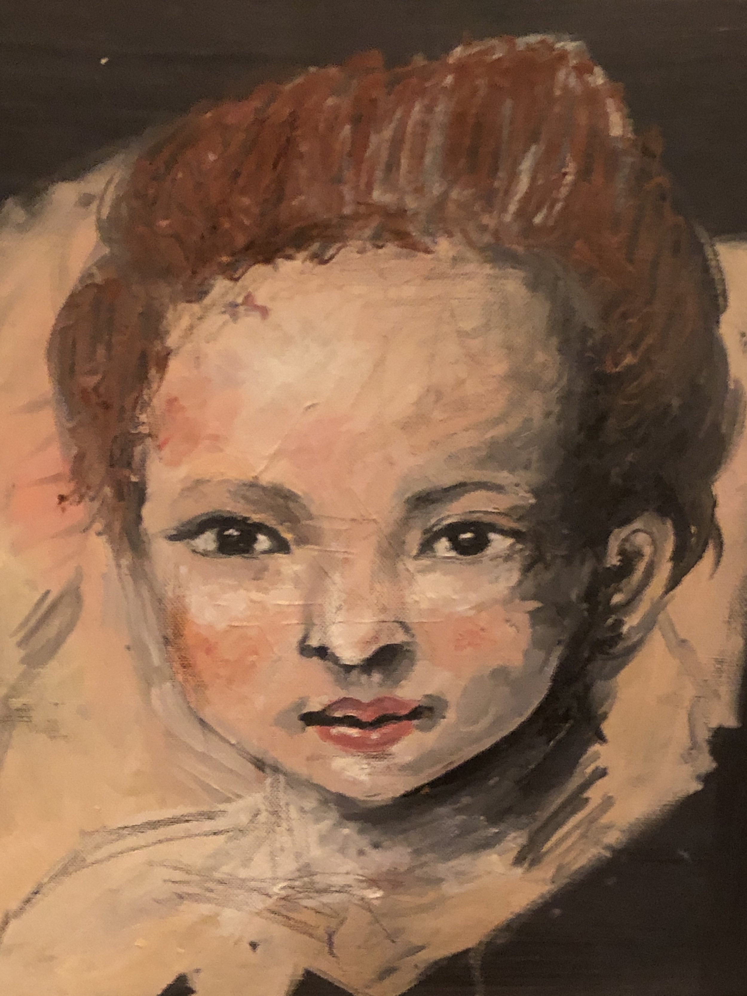 Child with Harlequin Eyes