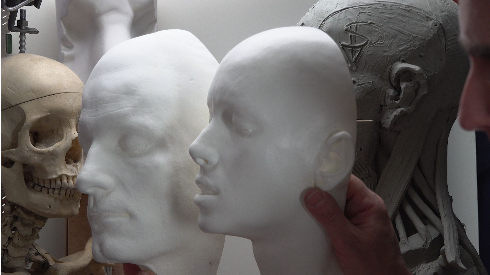 Pro_C0140_July_11_2025_Maier_Nose_part_1_00_58_24_27_Still052 (2).png