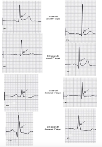From Annals of Internal Medicine