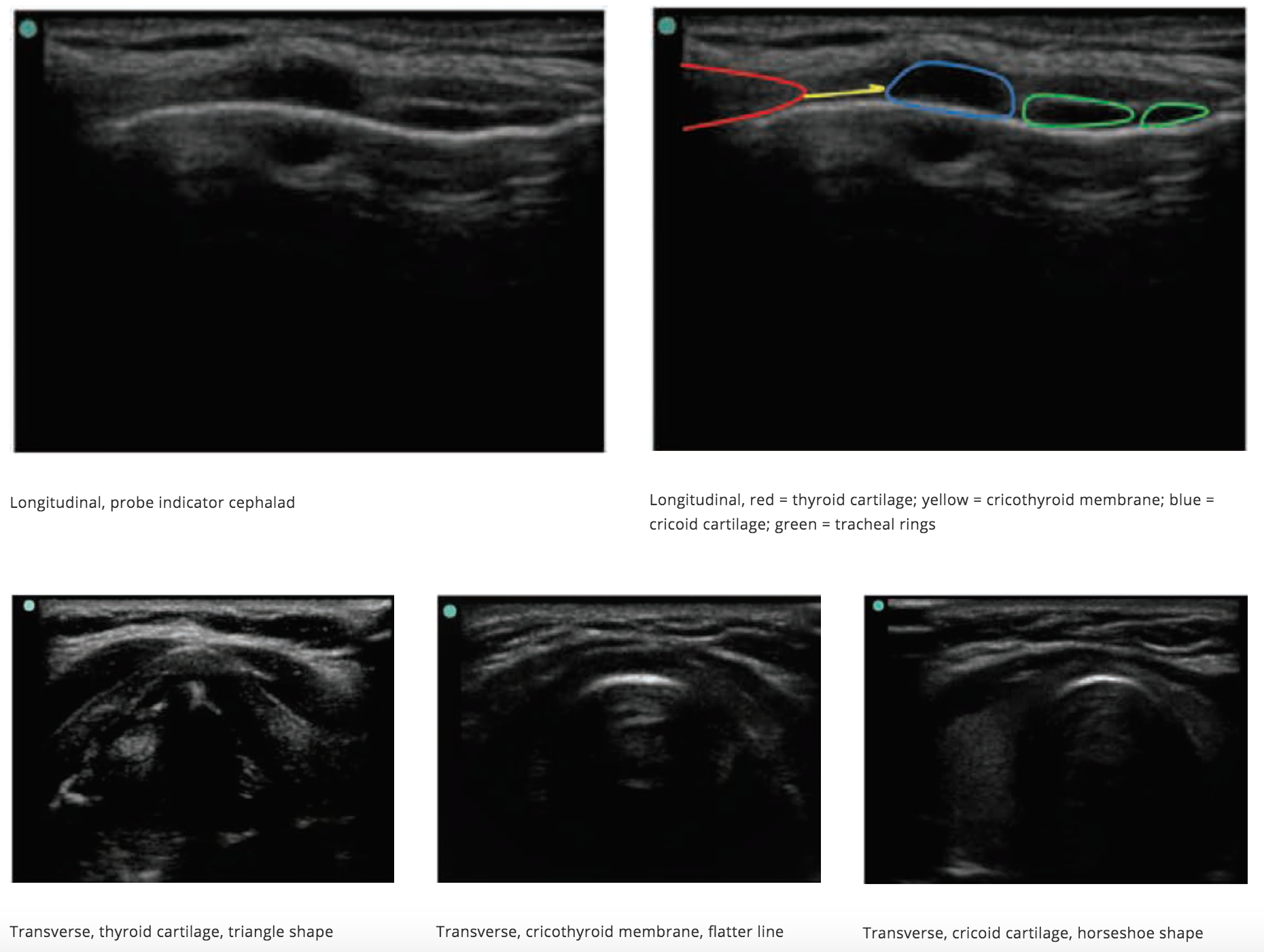 Figures are a composite from the cited article.