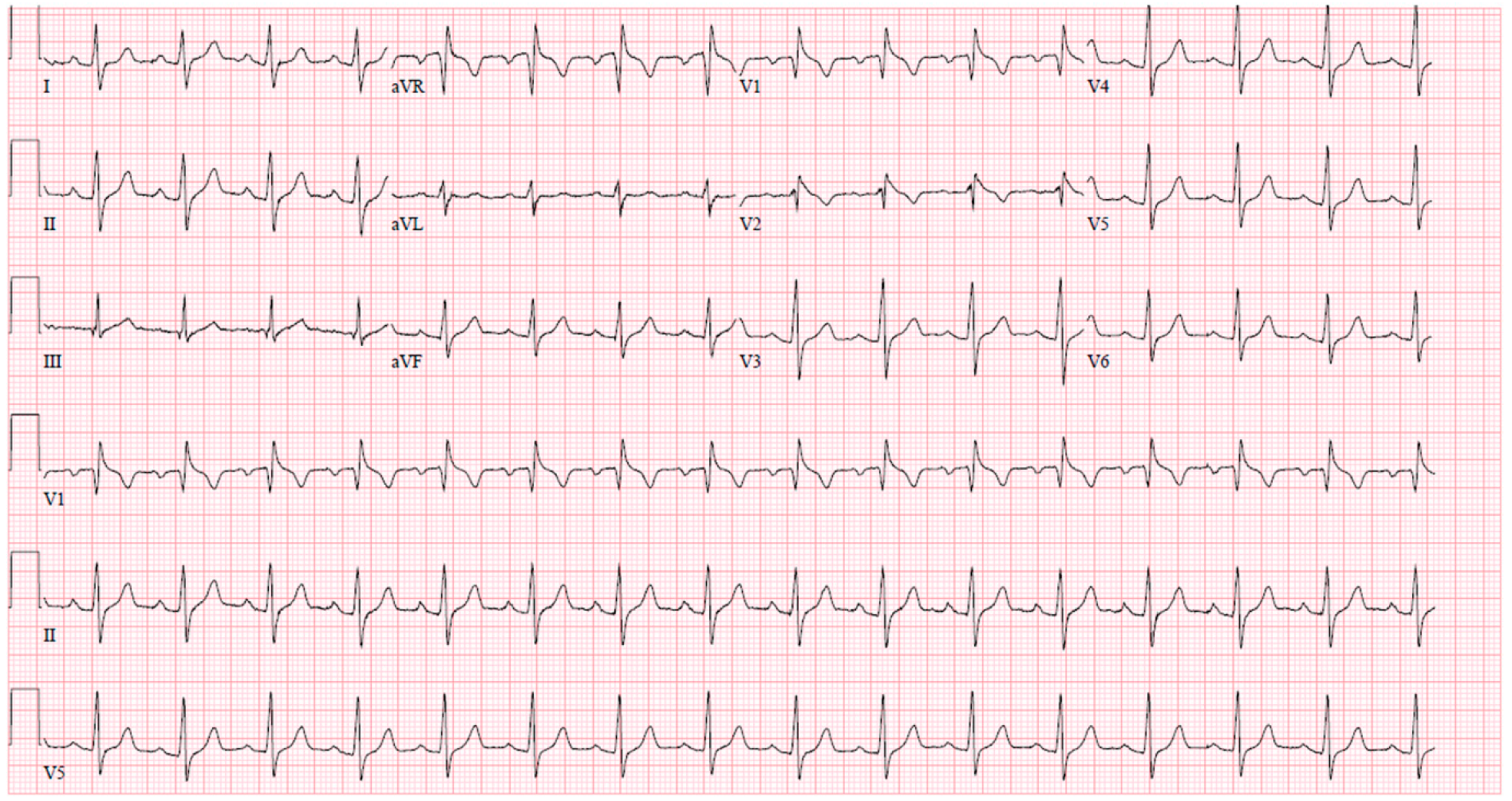 From cited article. What do you see here?