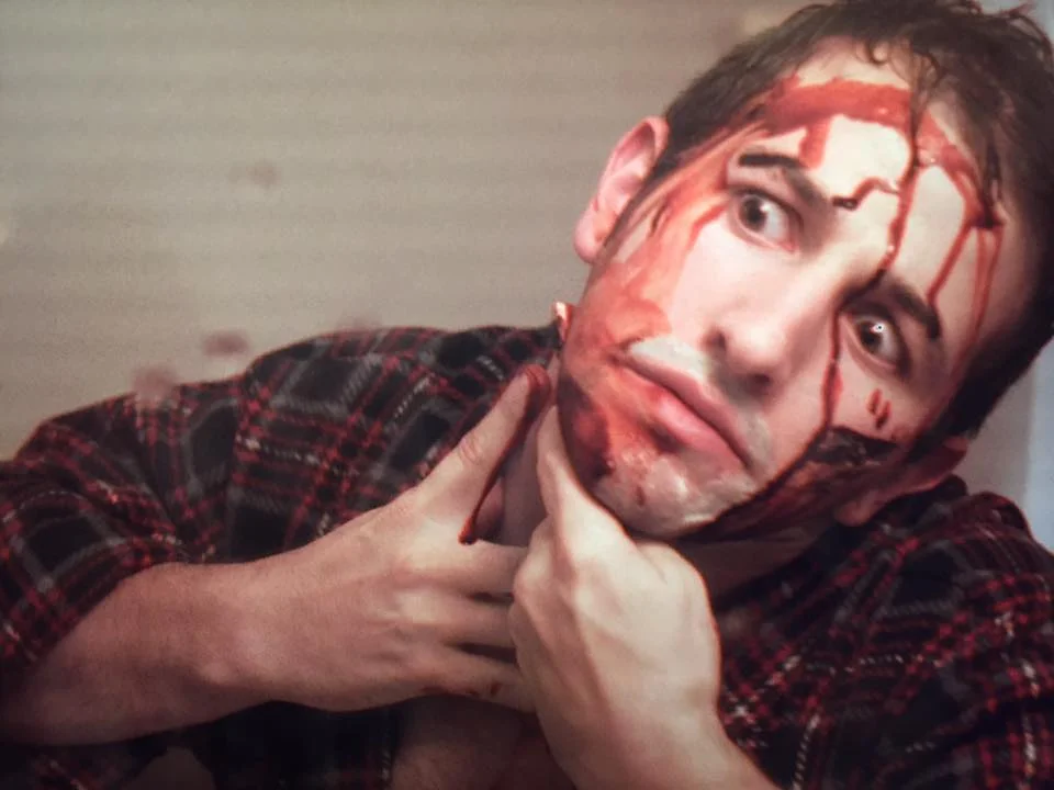 Joel's Face Peel.jpg