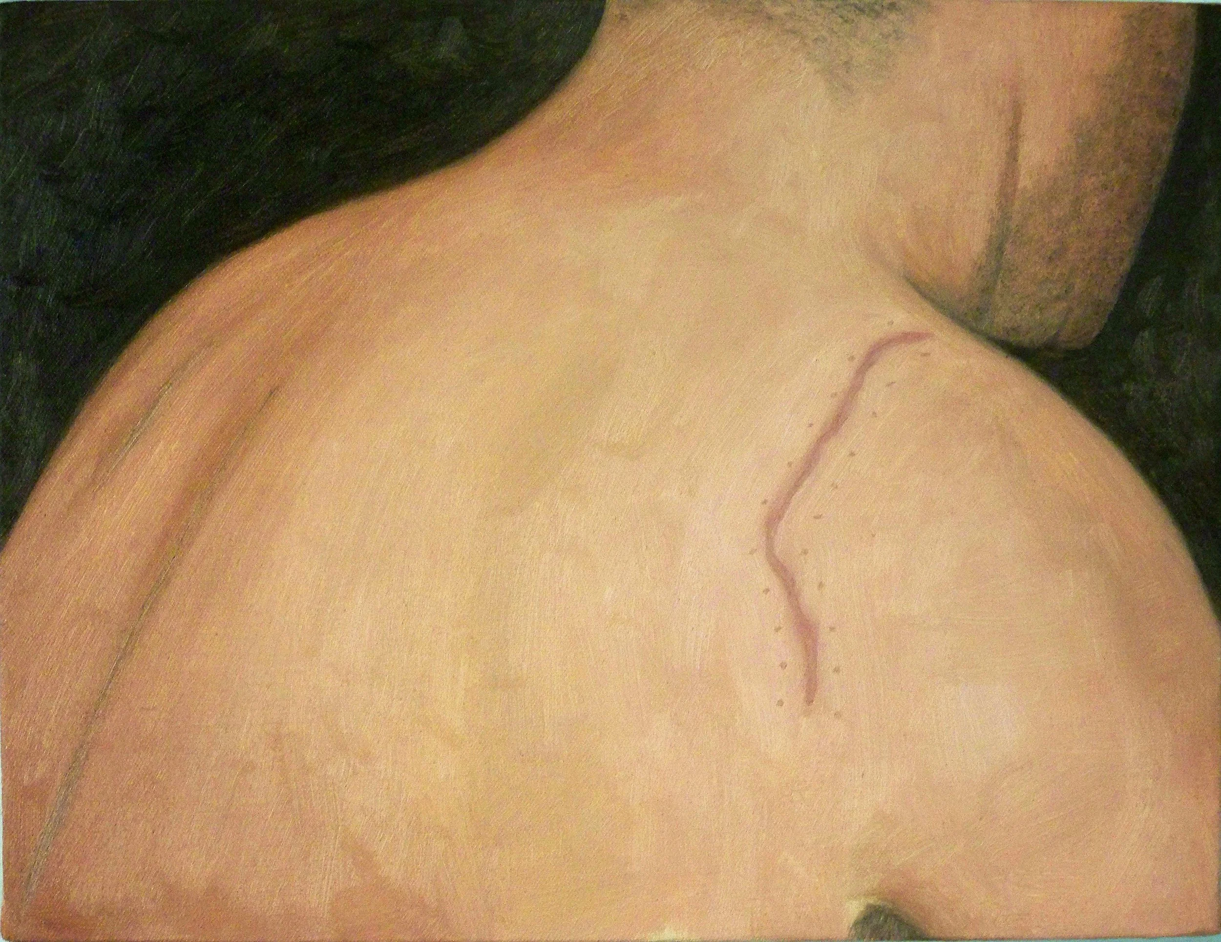 Human Series (Scar)