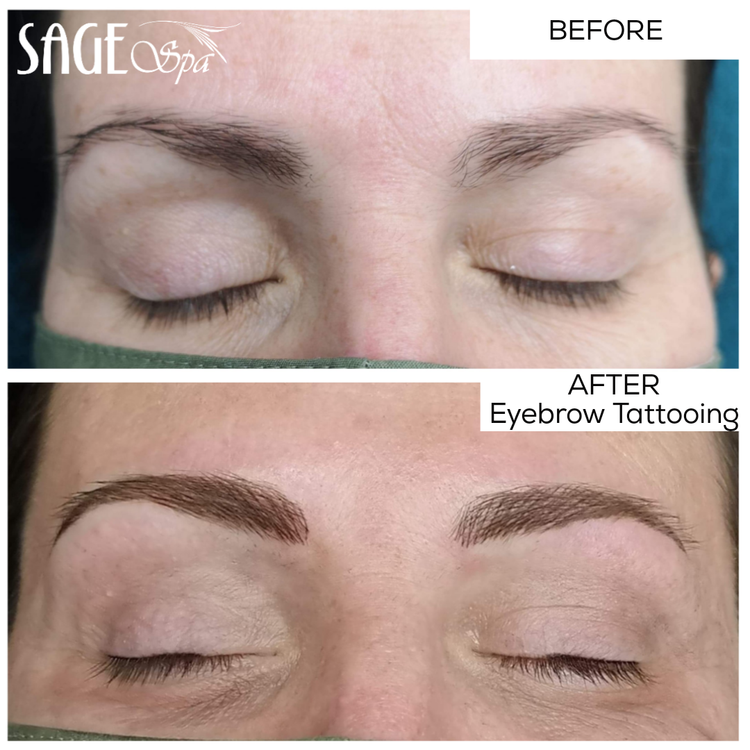 Thinning Eyebrows: What Causes It & How You Can Fix It. | DAELA