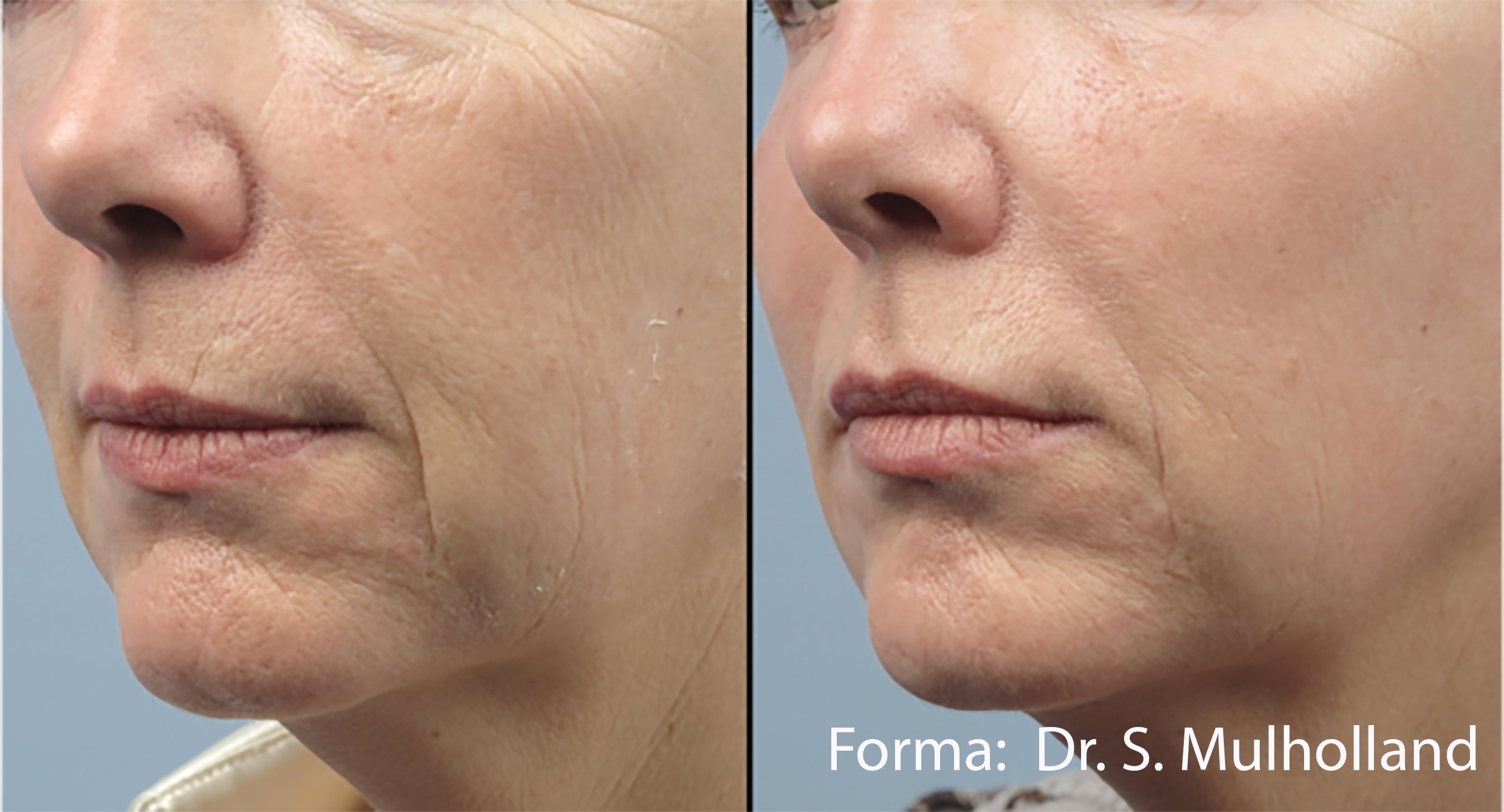 forma-before-after-dr-s-mulholland-preview-1.jpg