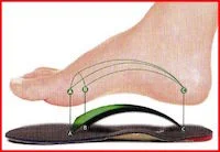 The best insoles don't force your foot arches. They retrain muscle and nerve memory by positive stimulation.