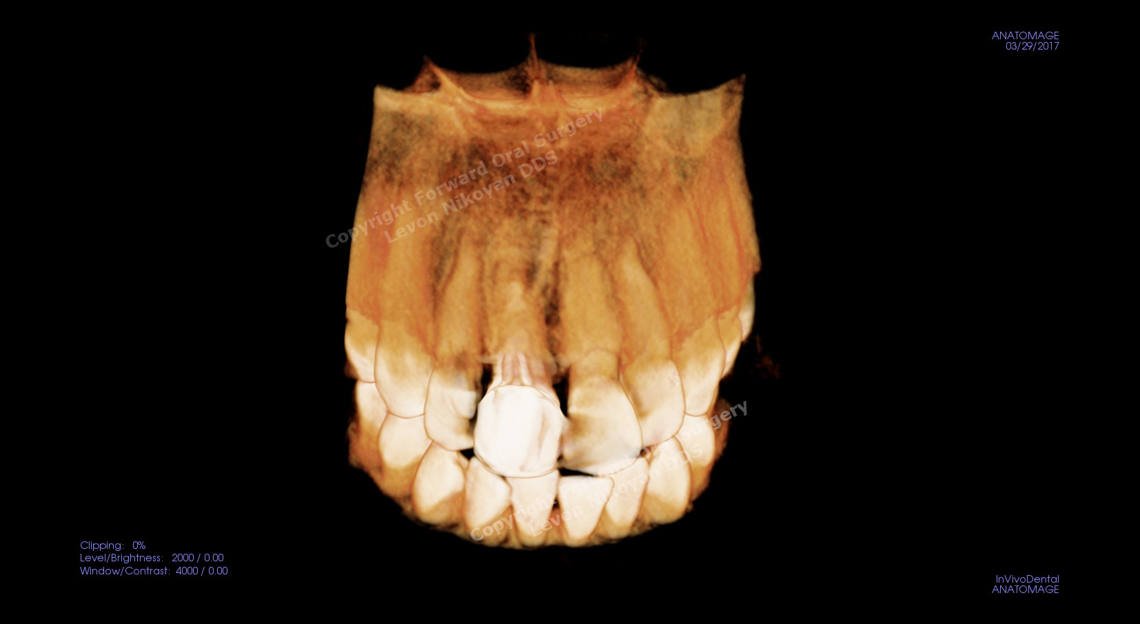 bgh4 (1).jpg