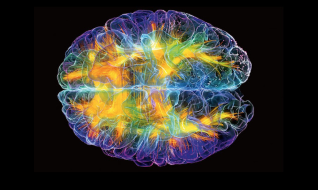 brain.png