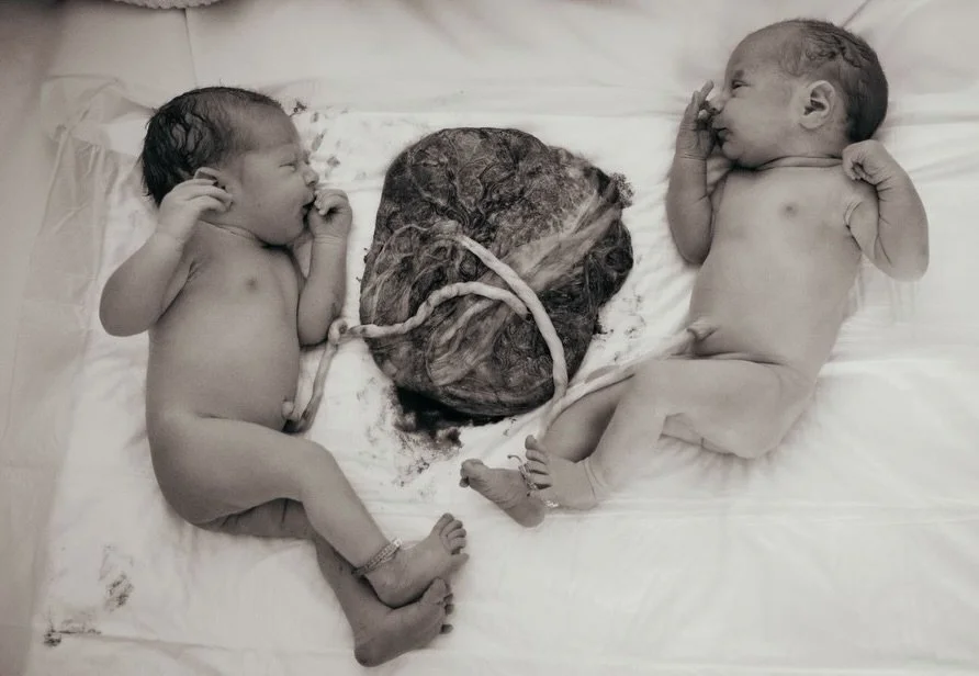 Swipe for the moment when baby A is in mom&rsquo;s arms &amp; we listen to baby B still inside. And then swipe again to see baby B born en caul (still in her amniotic sac). Truly a beautiful beautiful birth experience for this family 💗💗