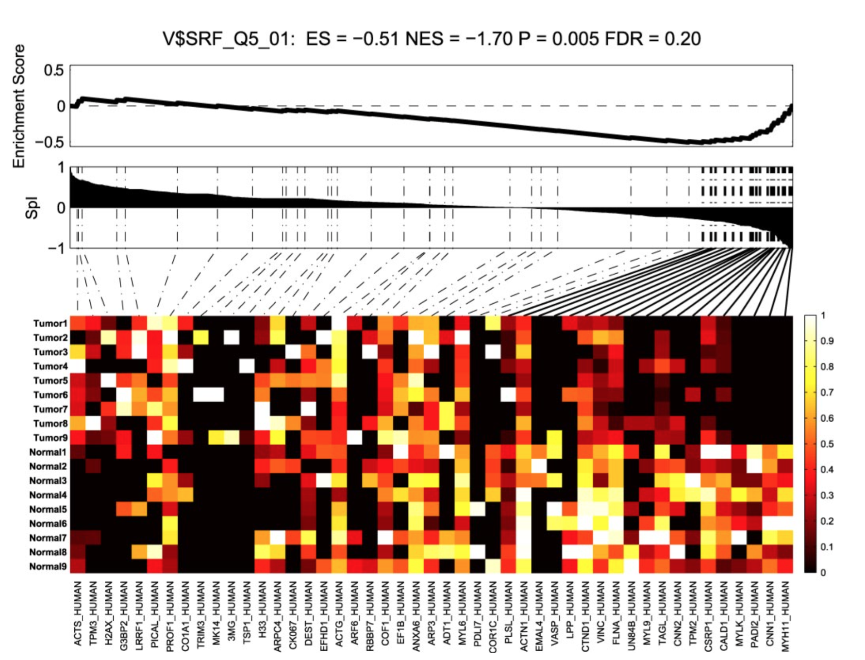 In situ proteomic analysis of human breast cancer epithelial cells using laser capture microdissection