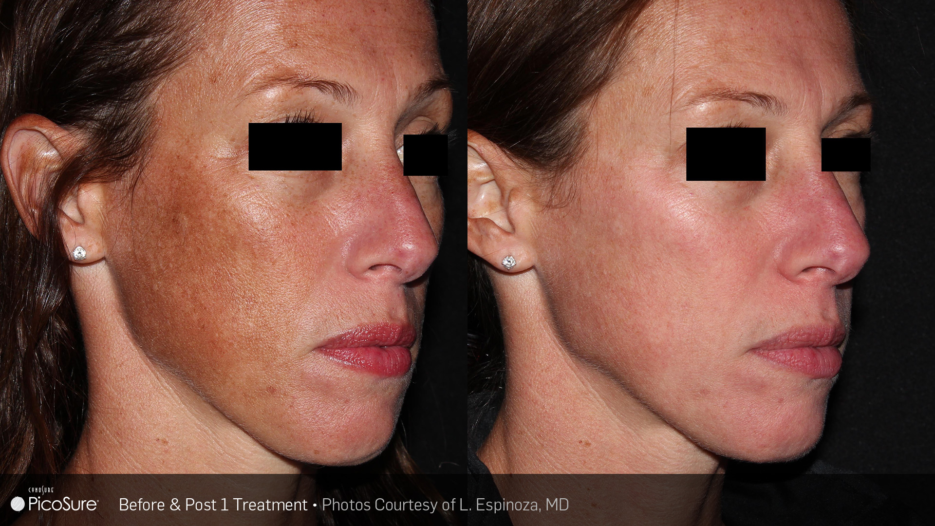 Skin Revitalization *